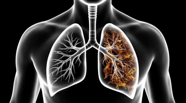 Парить – здоровью вредить!