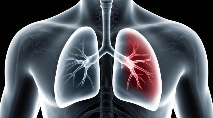 Долгий кашель – не всегда простуда…